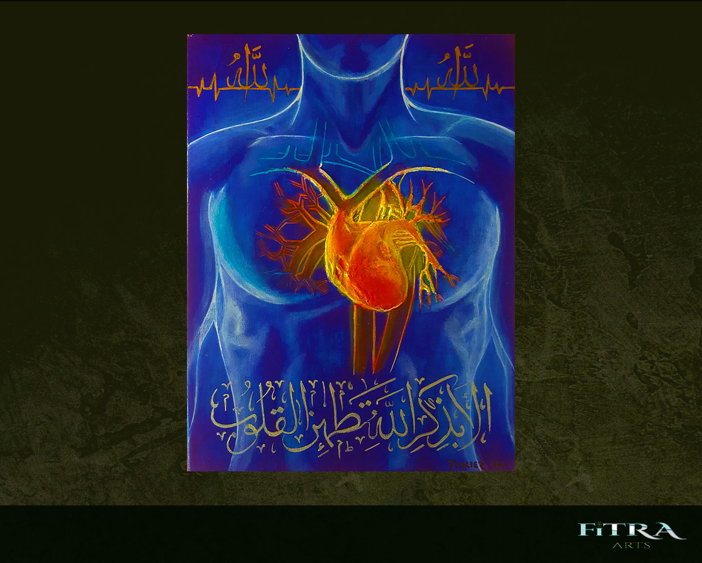 Medical Art - Heart (Print)